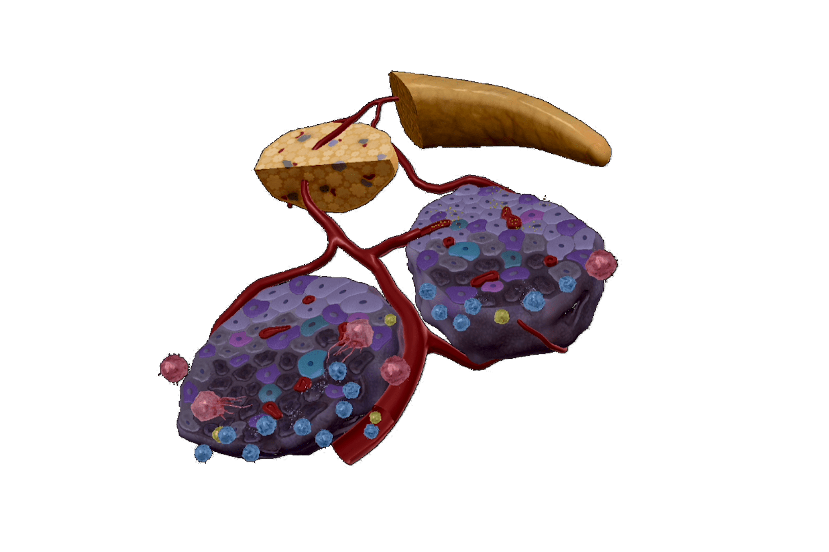 Insulin resistance sequence